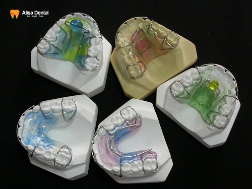 Niềng răng tháo lắp cho người lớn