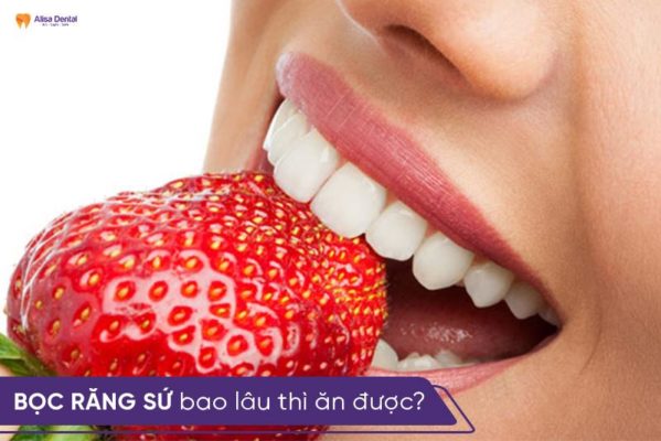 Bọc răng sứ bao lâu thì ăn được? 