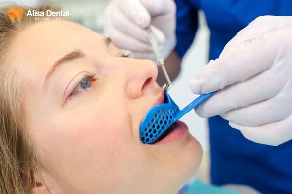 Bọc răng sứ hàm dưới 