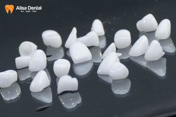 Bọc răng sứ nên kiêng gì 