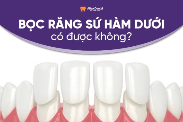 Bọc răng sứ hàm dưới có được không 1