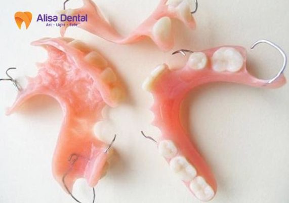 Làm hàm tháo lắp cải thiện mất răng hàm dưới