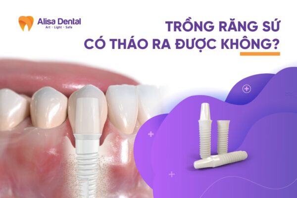 Tình Huống Cụ Thể trồng răng implant có tháo ra được không