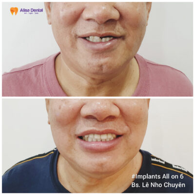 Khách hàng người Đài Loan