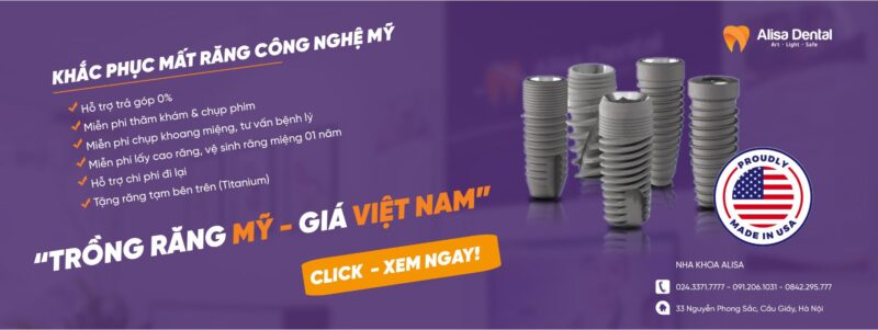 Trồng răng Implant công nghệ Mỹ