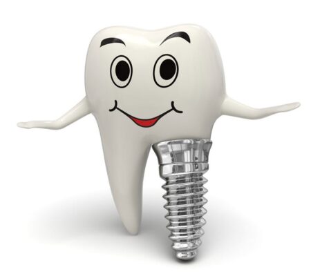 trồng răng Implant mất bao lâu 