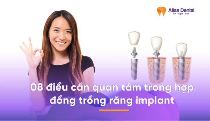 Hợp đồng trồng răng implant