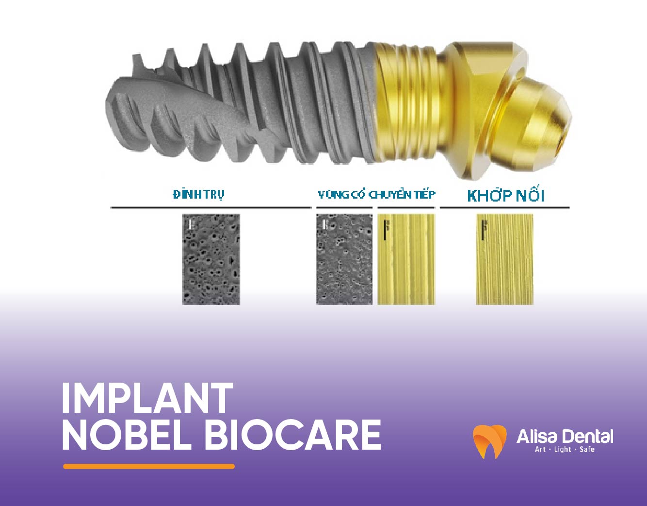 Trụ Implant nobel biocare từ Mỹ