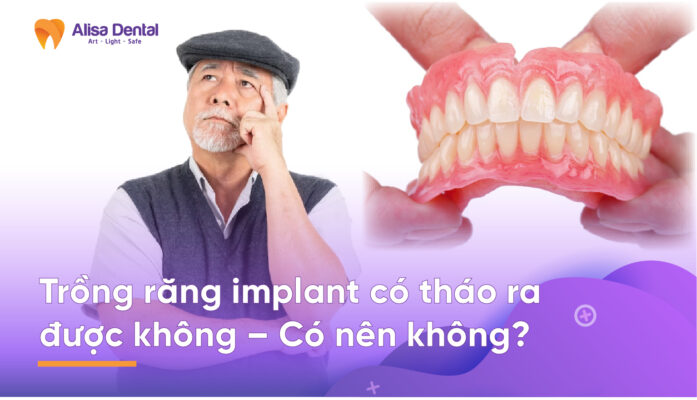 Trồng răng implant có tháo ra được không
