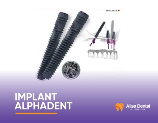 Trụ implant alphadent tính năng diệu kỳ