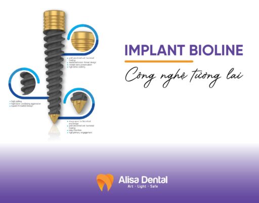 Trụ implant bioline công nghệ tương lai