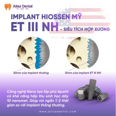 Implant Hiossen ETIII NH có công nghệ Nano, rút ngắn thời gian điều trị còn 1,5 tháng