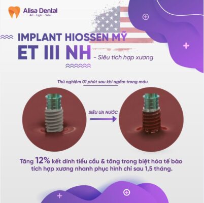 Implant Hiossen ETII NH của Mỹ có tính siêu ưa nước