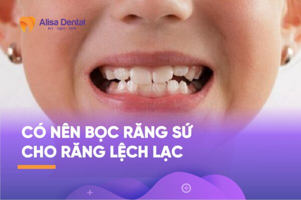 Có nên bọc răng sứ cho răng lệch lạc