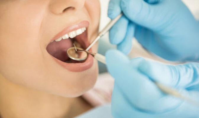 trồng răng implant 9