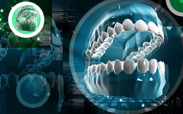 Công nghệ CAD/CAM hiện đại