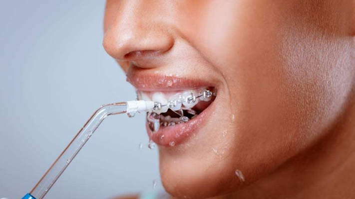 tăm nước tránh niềng rang hỏng