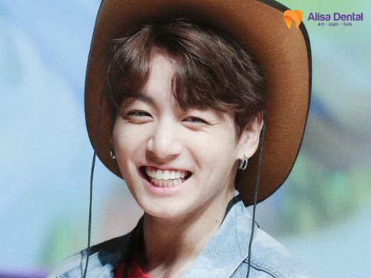 thẩm mỹ răng thỏ đẹp jungkook