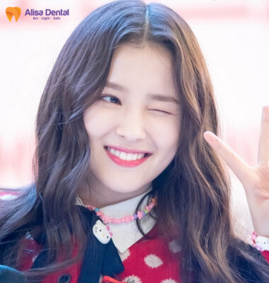 thẩm mỹ răng thỏ đẹp nancy