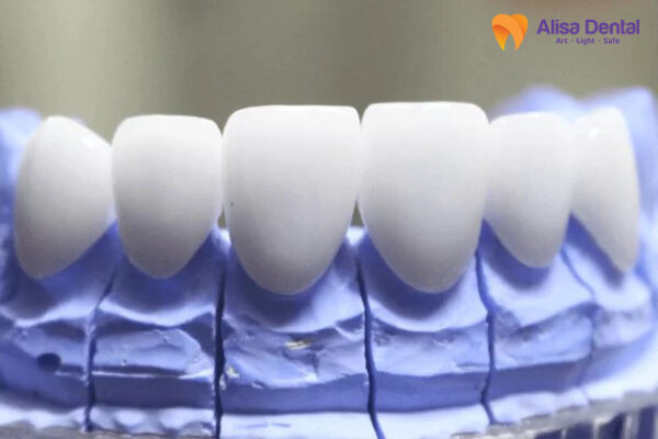 ceramill