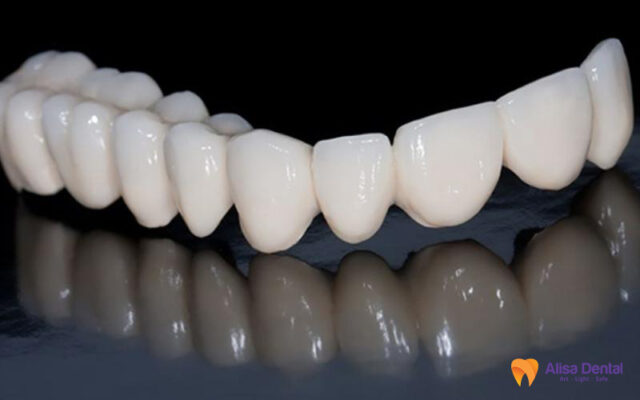 răng emax cad
