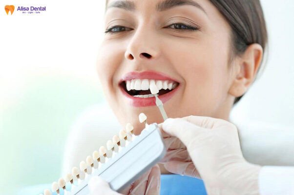 thẩm mỹ răng thỏ bằng dán veneer