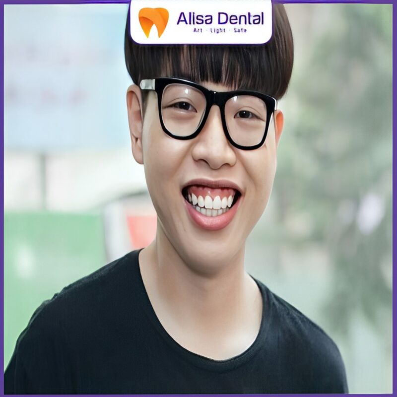 tình trạng cười hở lợi