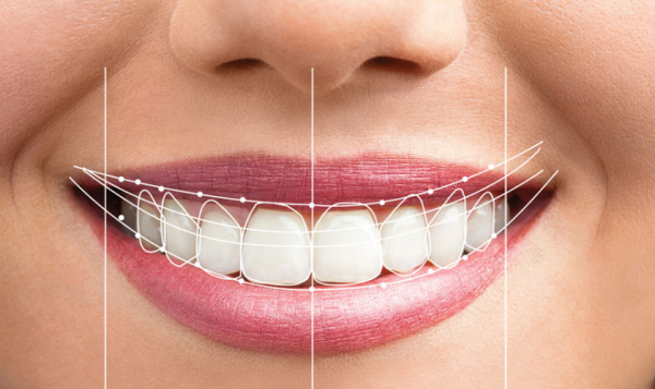 sai lệch khớp cắn khắc phục như thế nào