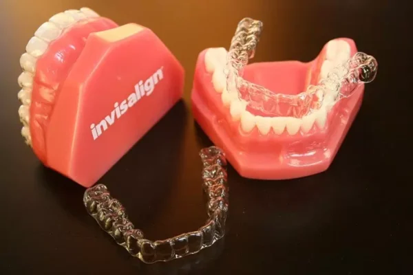 niêng răng Invisalign hoạt động ra sao