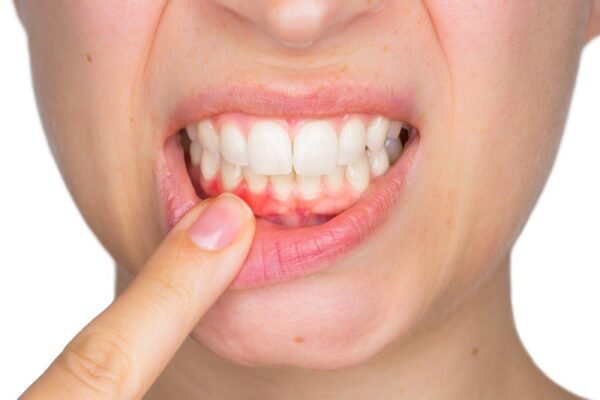 Vấn đề đau nhức và sưng tấy sau trồng răng implant