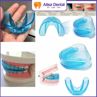 niềng răng giá rẻ tại nhà