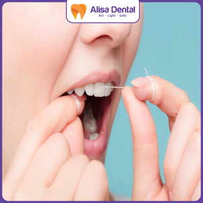 Lợi ích chỉ nha khoa