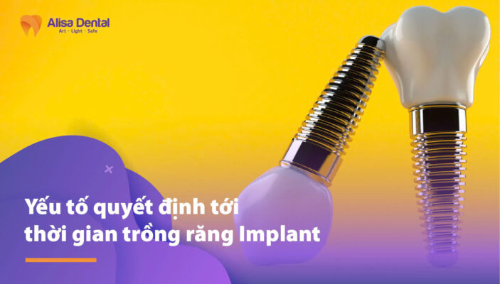Yếu tố quyết định tới thời gian trồng răng Implant