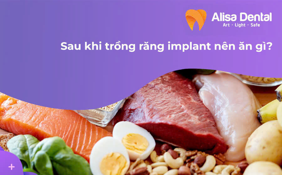 Sau khi trồng răng implant nên ăn gì