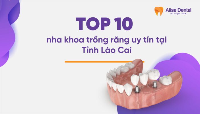 Top 10 nha khoa trồng răng uy tín tại Lào Cai