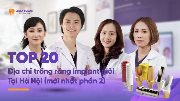 20 Địa Chỉ trồng răng Implant tốt nhất tại Hà Nội. (Phần 2)