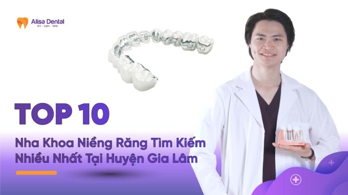 Top 10 Nha Khoa Niềng Răng Uy Tín Nhất Tại Quận Gia Lâm