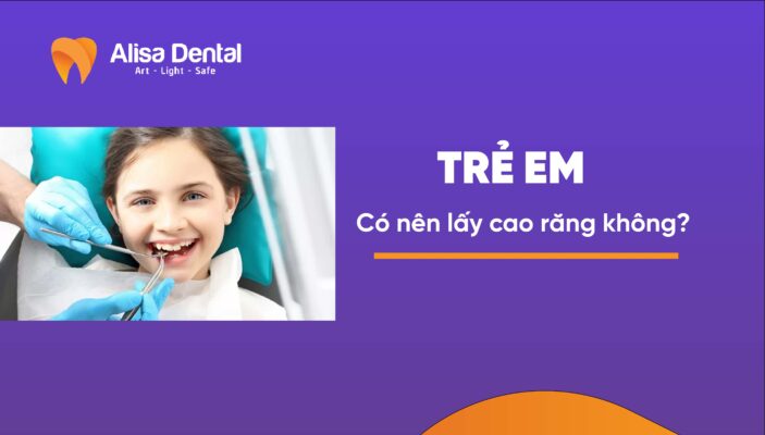 trẻ em có nên lấy cao răng