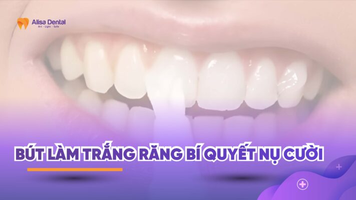 Bút làm trắng răng bí quyết nụ cười