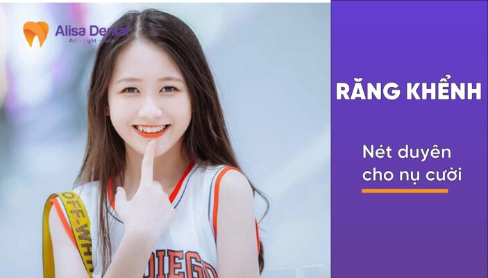 Răng khểnh: Nét duyên cho nụ cười