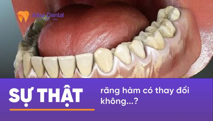 Sự thật răng hàm có thay đổi không