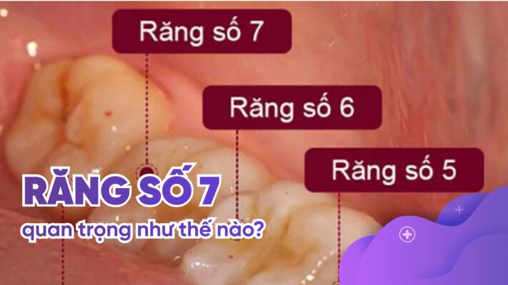 Răng số 7 quan trọng như thế nào?