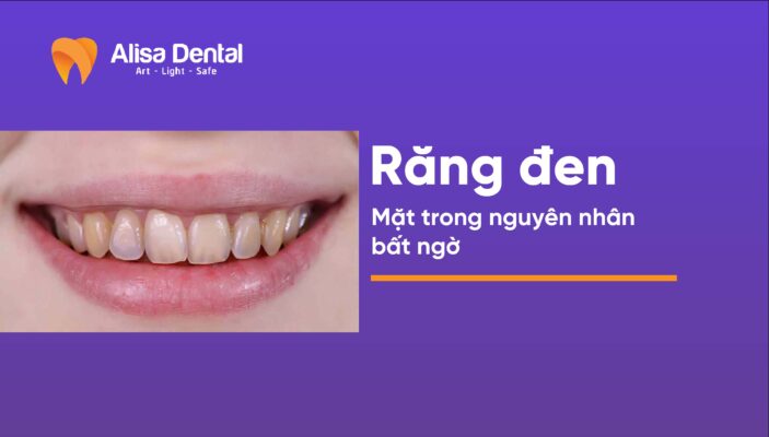 Răng đen mặt trong nguyên nhân bất ngờ