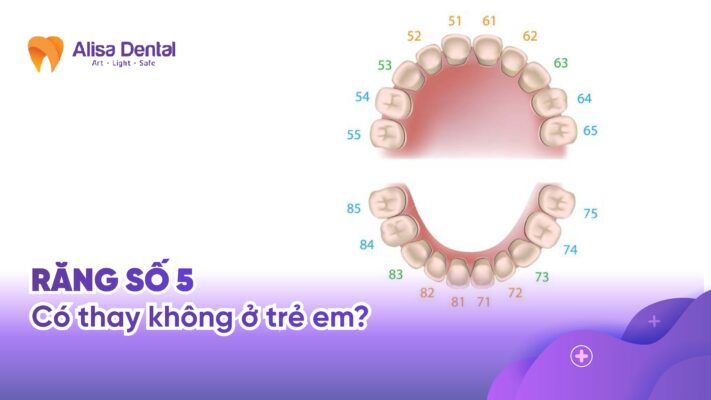 Răng số 5 có thay không ở trẻ em?