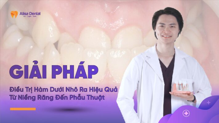 Giải Pháp Điều Trị Hàm Dưới Nhô Ra Hiệu Quả – Từ Niềng Răng Đến Phẫu Thuật