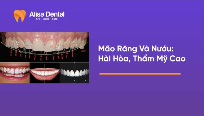 Mão Răng Và Nướu: Hài Hòa, Thẩm Mỹ Cao