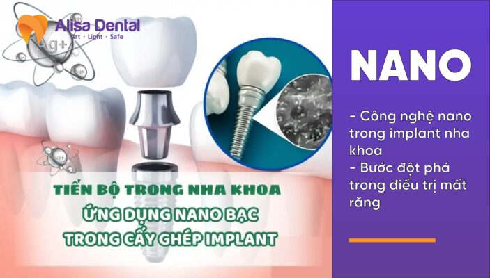 Công nghệ nano trong implant nha khoa