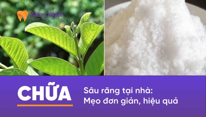 Chữa sâu răng tại nhà: Mẹo đơn giản, hiệu quả