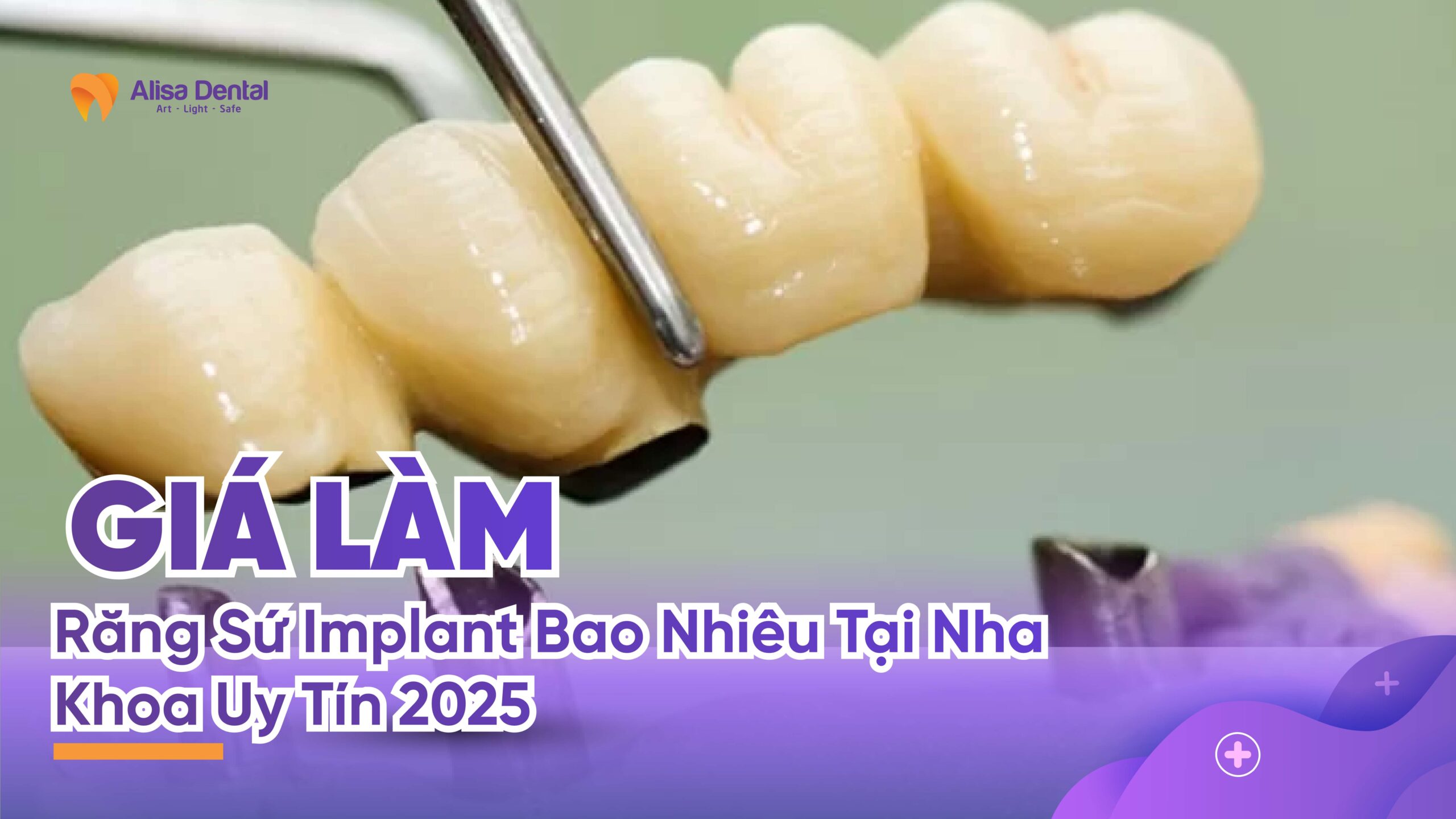 Giá Làm Răng Sứ Implant Bao Nhiêu Tại Nha Khoa Uy Tín 2026