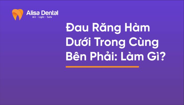 Đau Răng Hàm Dưới Trong Cùng Bên Phải: Làm Gì?
